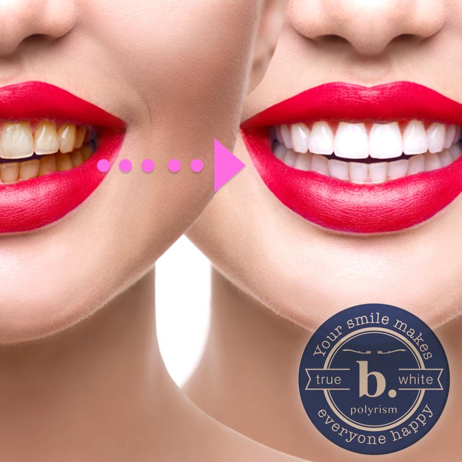 研磨剤未使用 発泡剤未使用 デンタル薬用ハミガキ 医薬部外品 ホワイトニング 歯周病 抗菌作用 ポリリン酸  60g b.glen ビーグレン公式 |  | 03