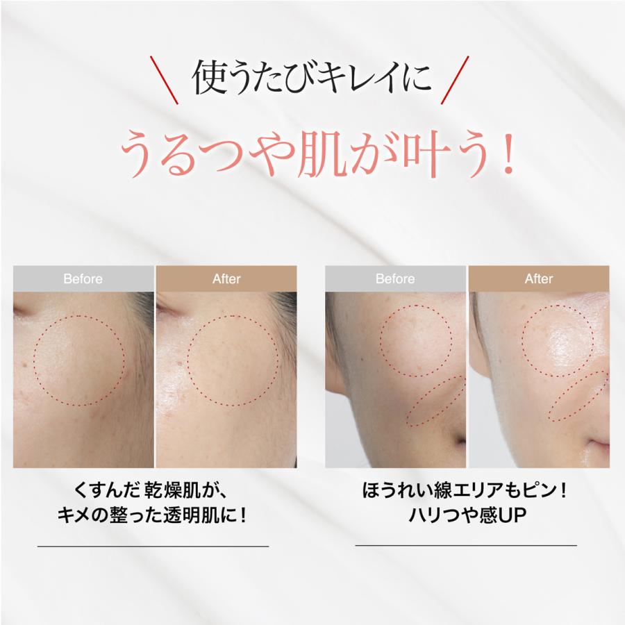 b.glen 【公式ショップ】ビーグレン(b.glen) QuSomeモイスチャー b.glen 【公式ショップ】ビーグレン(b.glen) QuSomeモイスチャー