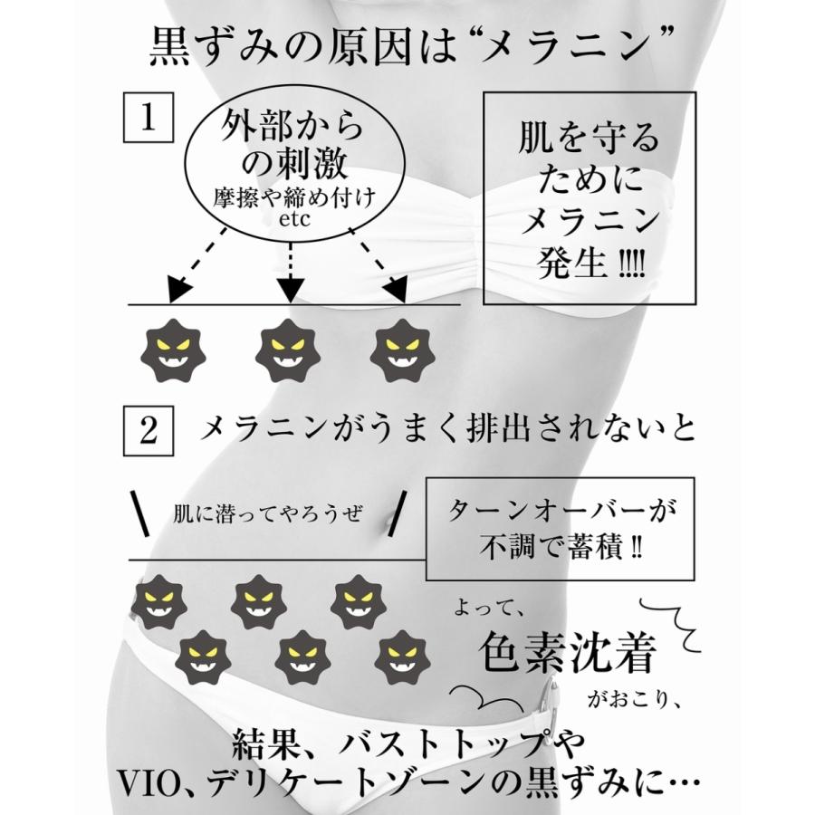 く日はお得 デリケートゾーン 黒ずみ クリーム 黒ずみケア 膝 肘 脇 美白クリーム お尻 乳頭保護 乳首 デリキュア トーンアップ ホワイトニング クリーム 薬用 Aynaelda Com