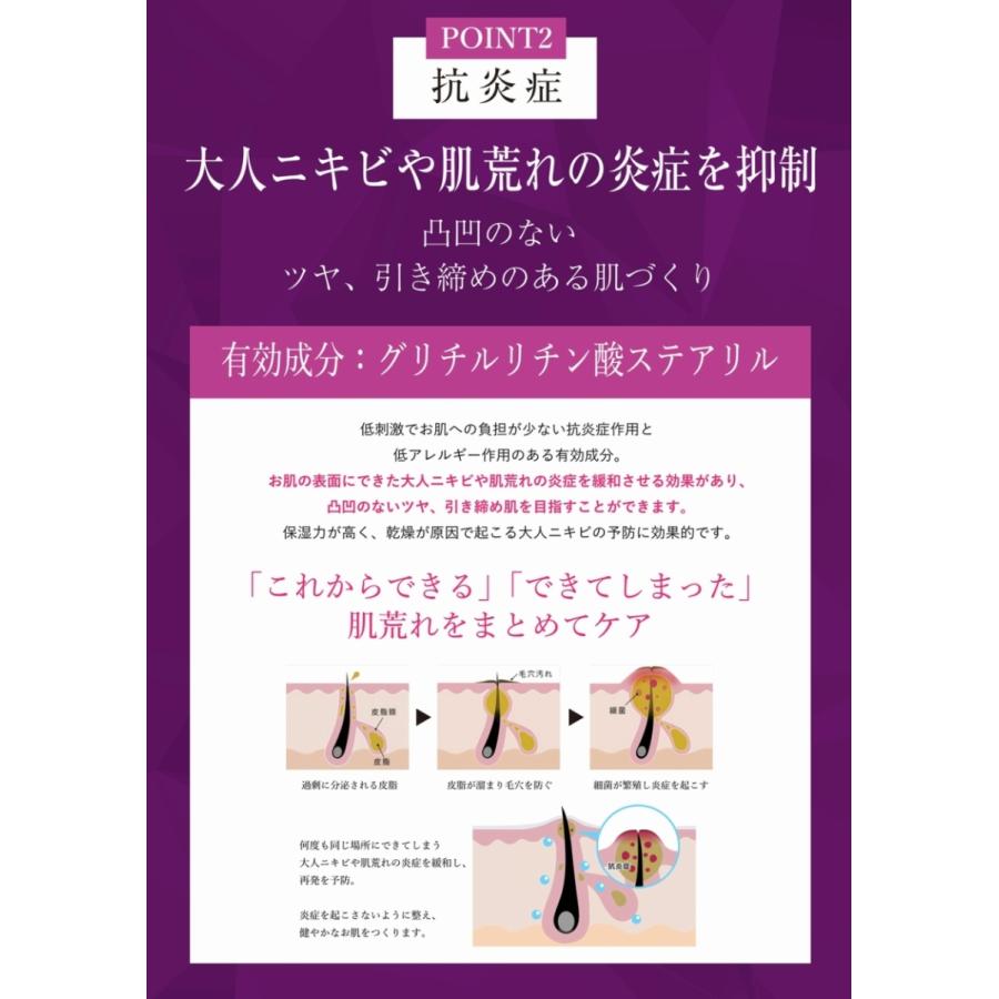 薬用 乳液 美白 保湿 美白化粧品 ニキビ ビタミンc ビタミンc