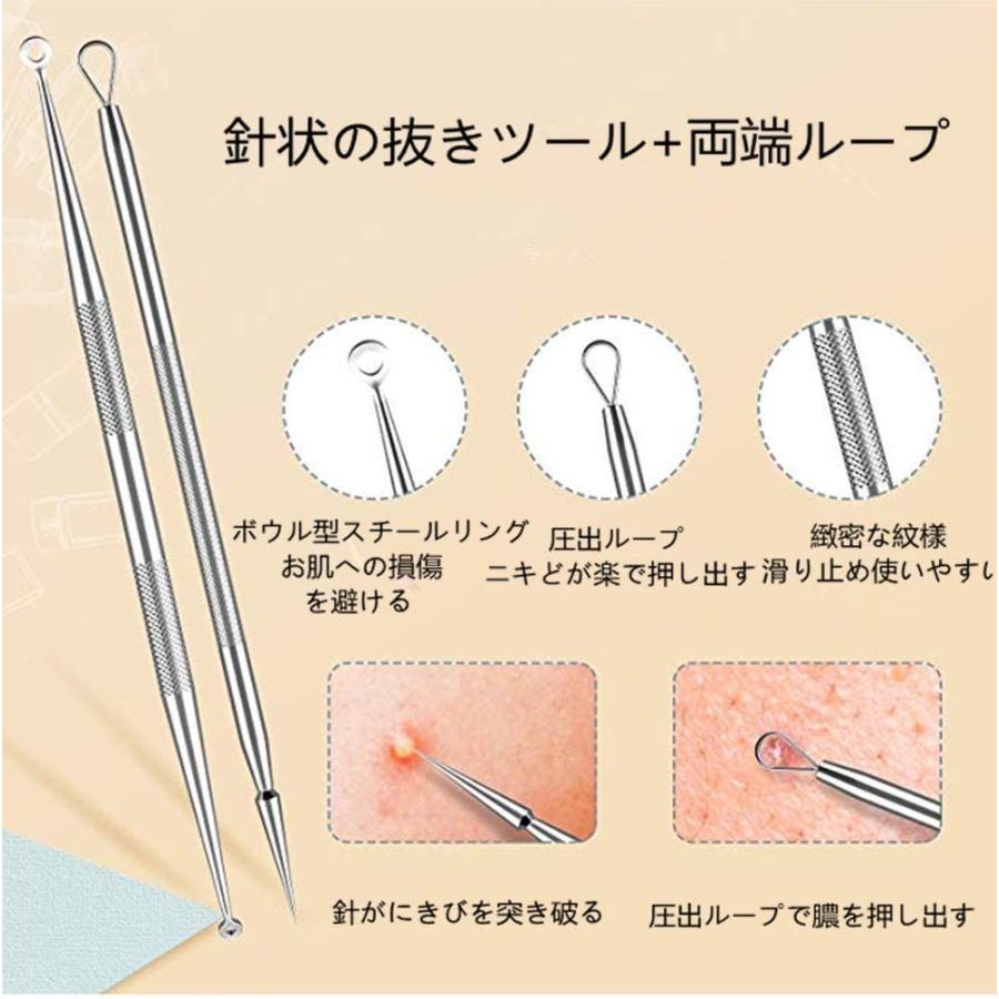 53 Off 毛穴ケア専用キット ニキビ取り 黒ニキビ除去 ステンレス製 角栓プッシャー 毛穴角栓すっきりスティック 携帯便利 収納ケース付き 5本セット Wantannas Go Id