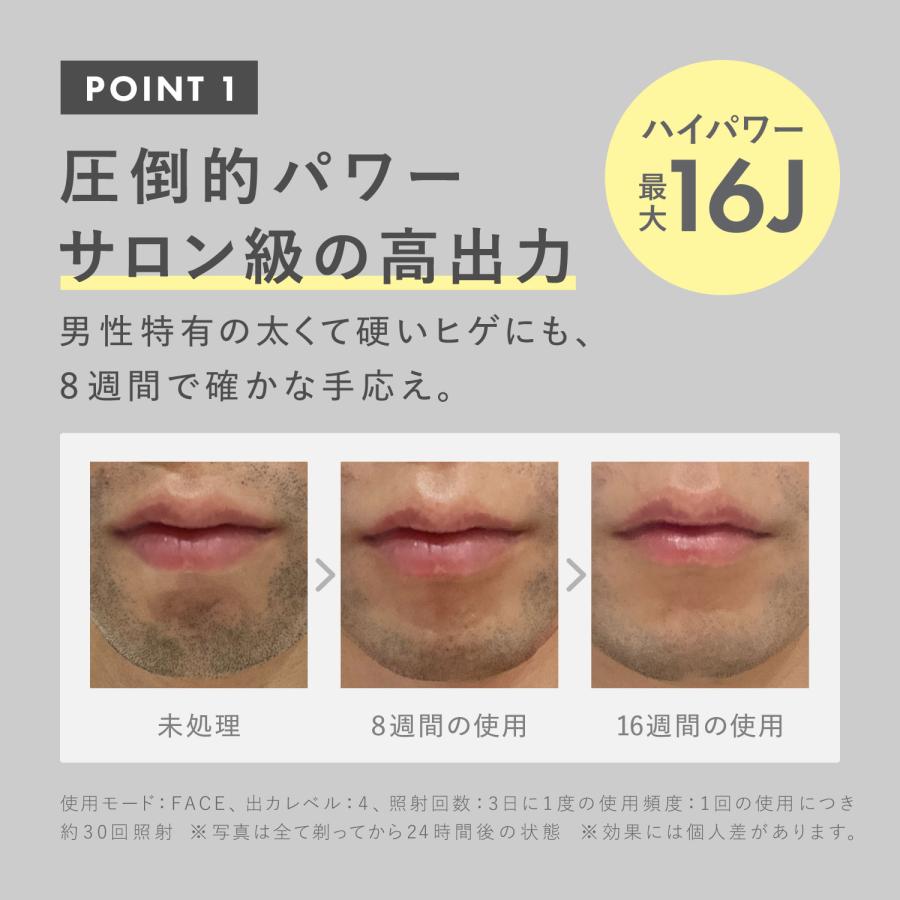 リデ Re・De 脱毛器 vio対応 冷感 冷却 ハイパワー 4段階 家庭用 UVスタンド付き DuoClear IPL 光美容器 ホワイト 白 BR01Aの画像