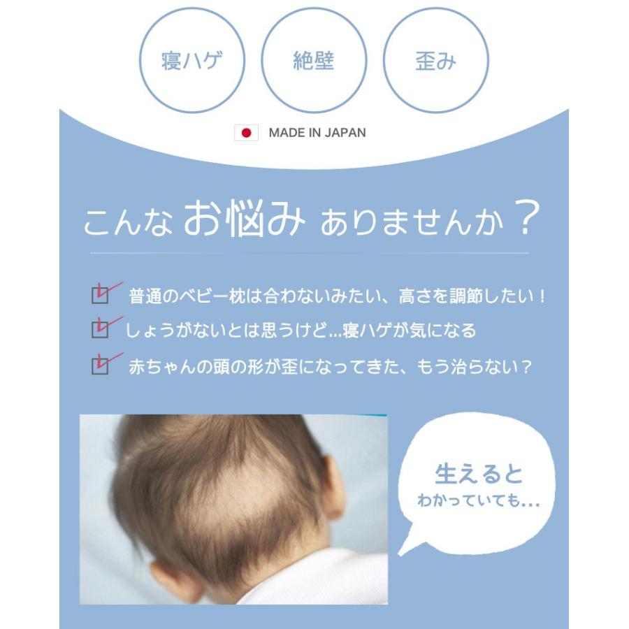 ベビー枕 エスメラルダ ドーナツ枕 出産祝い 頭の形 赤ちゃん ベビーまくら Esm008 おむつポーチとスイマーバの美人家 通販 Yahoo ショッピング
