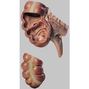 ソムソ社 虫垂と盲腸模型 js7　 | 