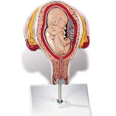 3B社  人体模型 　妊娠・胎児模型　妊娠5ヶ月の子宮モデル(骨盤位)　（l10-5) 　　｜biomedicalnet