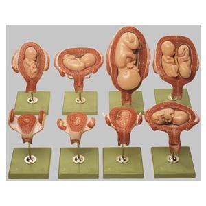 無料健康相談 対象製品 ソムソ社 妊娠子宮経過模型 ms12 鍼灸 模型 