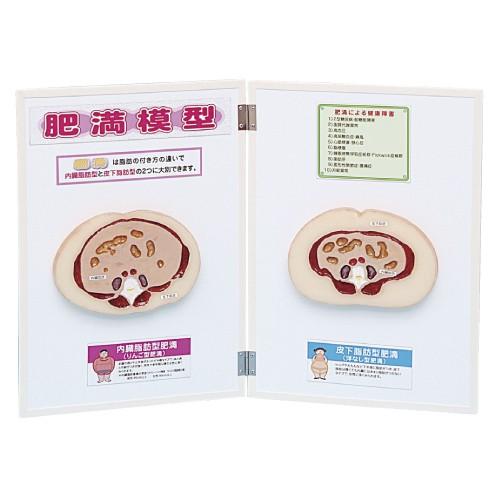 【内臓脂肪】 肥満の原因と効くメカニズム｜脂肪を燃やす！腸の働きを良くして