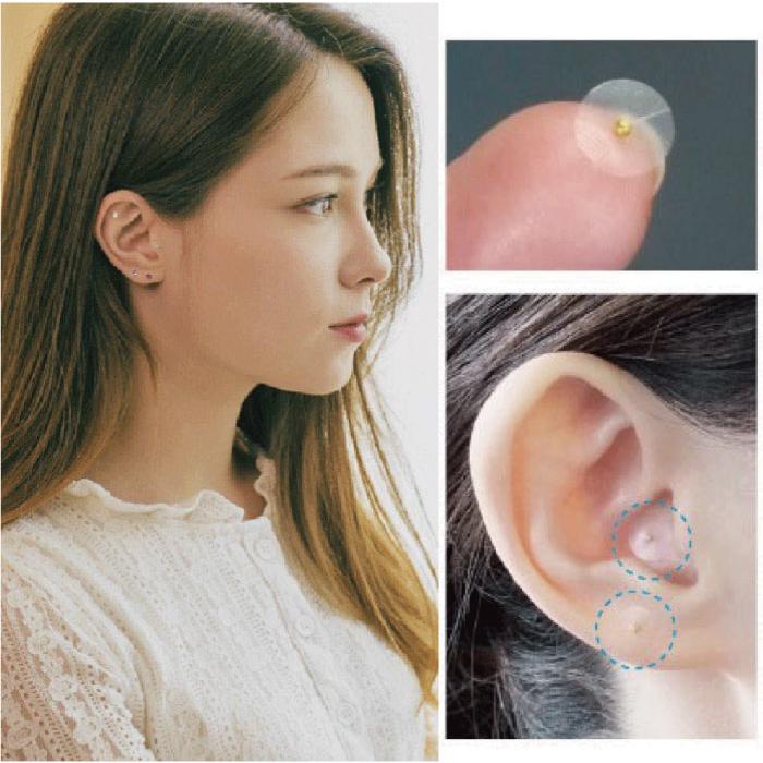 耳つぼシール120粒 当店オリジナル 、耳つぼカウンセラー監修の耳ツボ