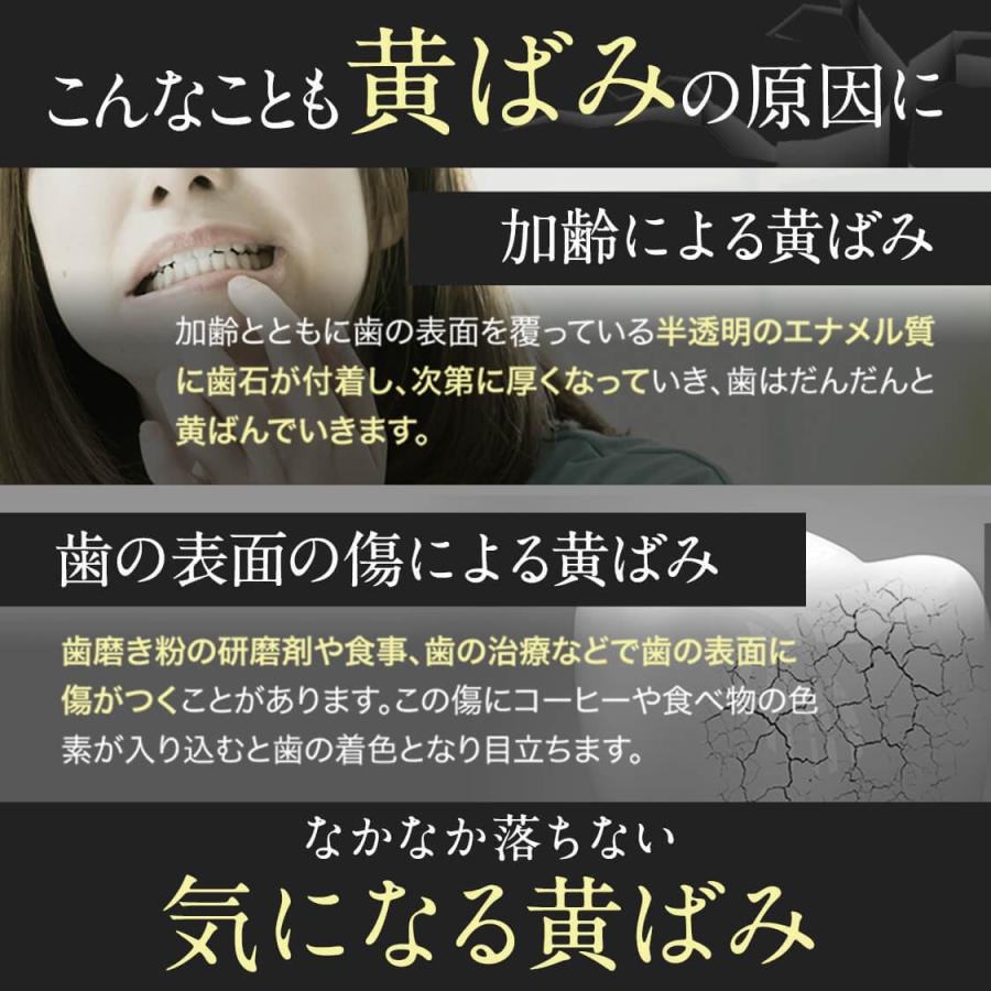 ホワイトニング 歯磨き粉 歯磨きジェル ブレッシュホワイトニング 30g 1個 黄ばみ やに 歯周病 口臭対策 ポリリン酸 セルフ 美白 Breashwhite 1 Bizentoヤフー店 通販 Yahoo ショッピング