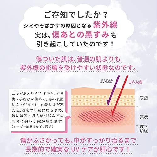 Skinix エアウォールuv 約97 Uvブロック フィルム 19mm 3m 1巻 シミ取り ほくろ除去後のケアに 貼る 日焼け止め 防水 テープ S 2702 Bless Yahoo ショップ 通販 Yahoo ショッピング