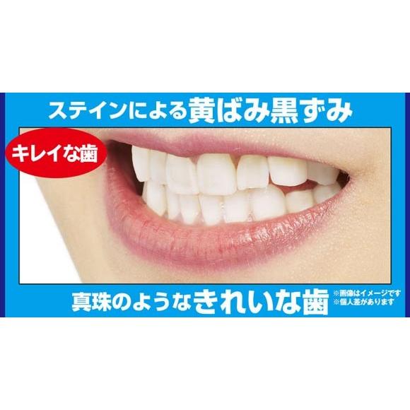 5本セット　ホワイトニング　薬用重曹ステインプロ ホワイトニングレーザー　医薬部外品｜blue-heaven｜06