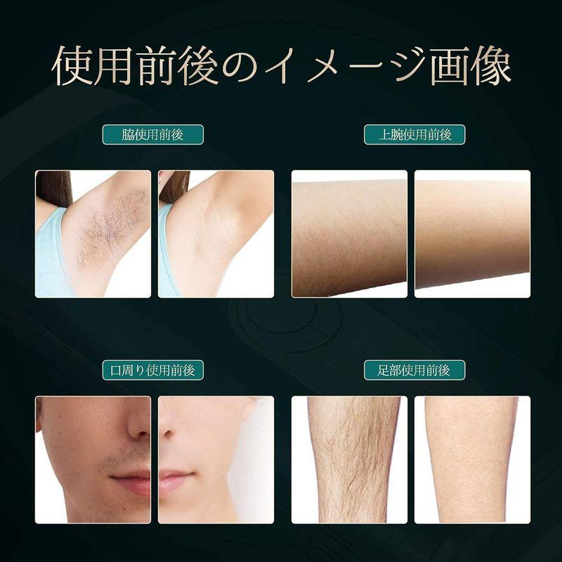Omuse IPL光脱毛器 国内サロン級 光美容器 だつもうき脱毛器 メンズ 髭