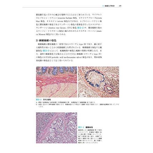 臨床に活かす病理診断学 第3版: 消化管・肝胆膵編 : Blue Hawaii