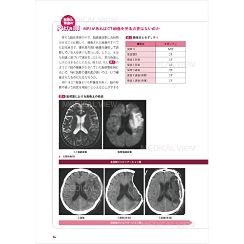 コツさえわかればあなたも読める リハに役立つ脳画像?改訂第2版