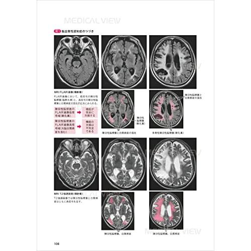 リハに役立つ脳画像 コツさえわかればあなたも読める＋他2冊 コツさえわかればあなたも読める リハに役立つ脳画像−改訂第2版