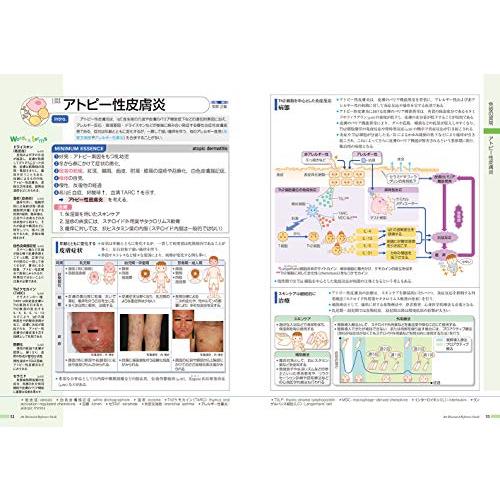 病気がみえる vol.6 免疫・膠原病・感染症 : Blue Hawaii - 通販