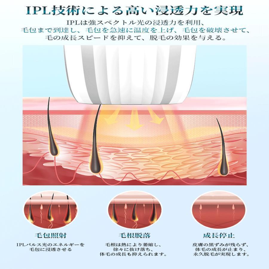 脱毛器 IPL光脱器 永久脱毛 家庭用脱毛器 自動照射 レーザー vio対応 メンズ レディース 脇 腕 足 背中 全身用 LED液晶 全身適用｜bokai-store｜09