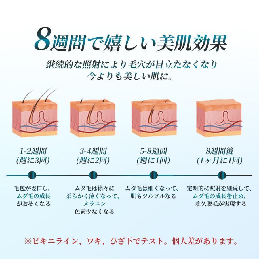 脱毛器 IPL光脱器 永久脱毛 家庭用脱毛器 自動照射 レーザー vio
