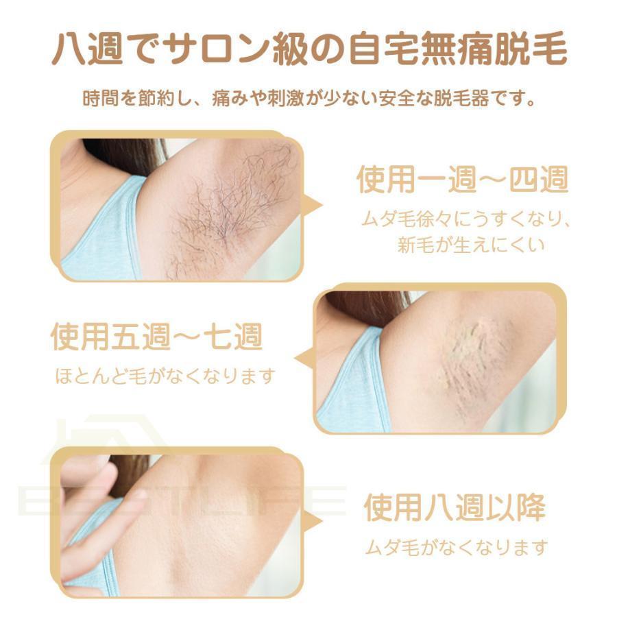脱毛器 メンズ 髭 女性 vio対応 冷感 IPL光美容器 サロン級 ヒゲ