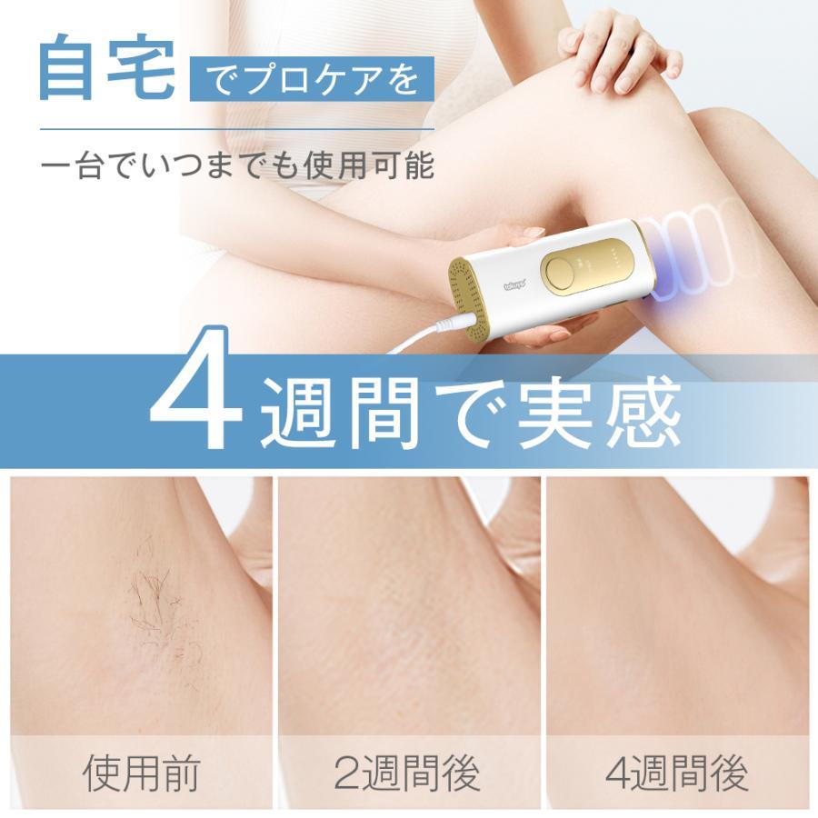 脱毛器 HIPL脱毛器 家庭用 光脱毛器 業界最新級 HIPL技術 冷却 照射無制限 光美容器 全身 VIO ひげ メンズ 顔 美肌 5段階 4つのモード 痛くない 簡単 脱毛機 | TAKUYO | 13