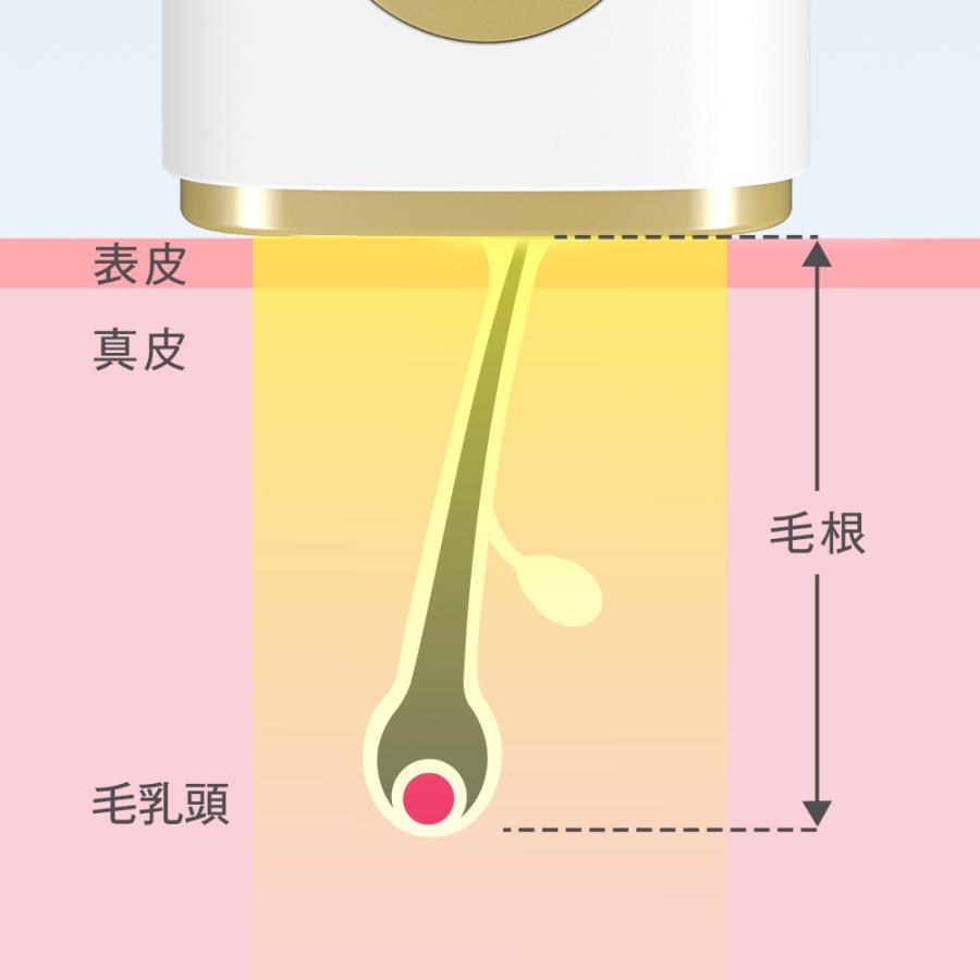 脱毛器 HIPL脱毛器 家庭用 光脱毛器 業界最新級 HIPL技術 冷却 照射無制限 光美容器 全身 VIO ひげ メンズ 顔 美肌 5段階 4つのモード 痛くない 簡単 脱毛機 | TAKUYO | 04