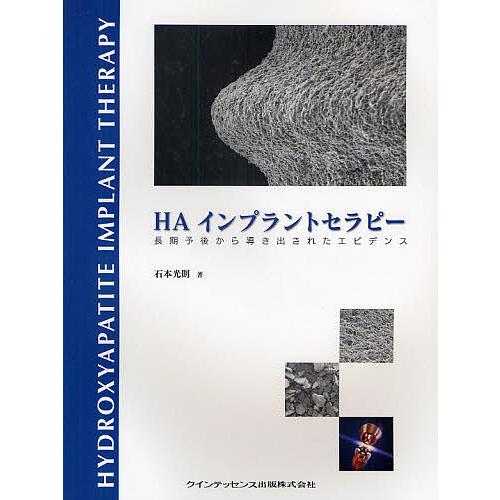 本 【裁断済み】インプラントセラピー 臨床的アプローチと成功の根拠