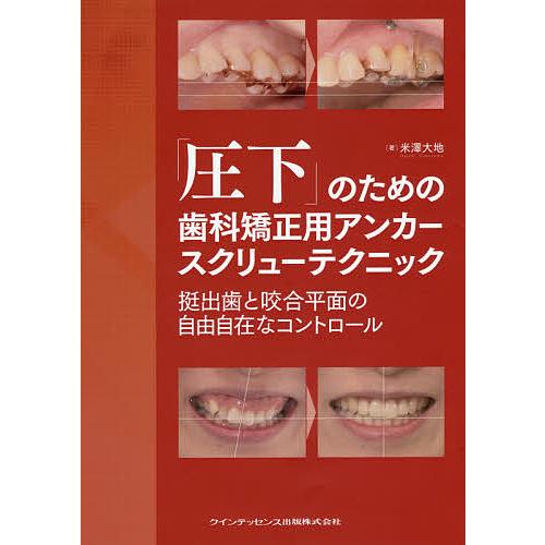 裁断済み】パーシャルデンチャー治療失敗回避のためのポイント47