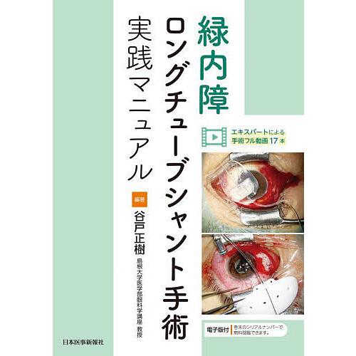 緑内障ロングチューブシャント手術実践マニュアル/谷戸正樹 : bookfan 