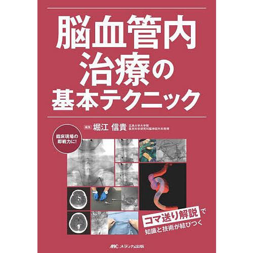 脳血管内治療の基本テクニック 脳血管内治療の基本テクニック/堀江信貴 : bookfanプレミアム - 通販