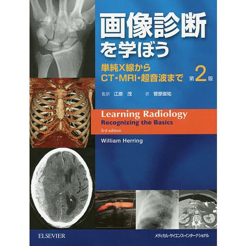 画像診断を学ぼう 単純X線からCT・MRI・超音波まで/ウィリアムヘリング 