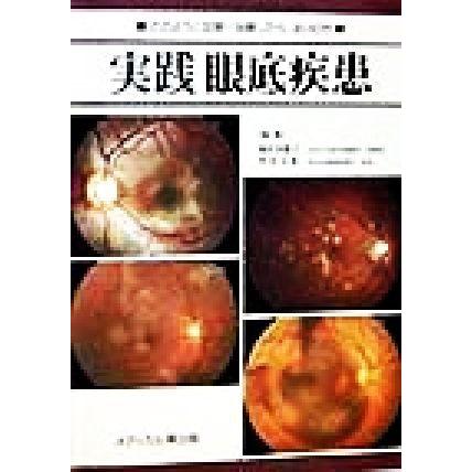 楽天カード分割 実践 眼底疾患 どのように診断 治療したらよいのか 湯沢美都子 編者 竹田宗泰 編者 激安の Atinkaonline Com