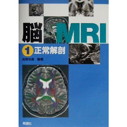 脳MRI(1) 正常解剖/高橋昭喜(著者) : ブックオフ1号館 ヤフー