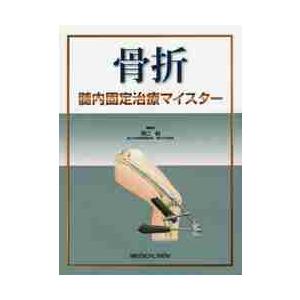 骨折髄内固定治療マイスター 骨折 髄内固定治療マイスター | 澤口 毅 |本 | 通販 | Amazon