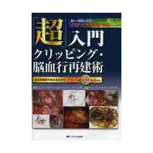 超 入門クリッピング 脳血行再建術 脳血管障害手術まるわかり 全術式のｗｅｂ動画付き 美しく理解しやすいイラスト 手術画像 動画で学ぶ 脳神経外科学 Canipec Org Mx