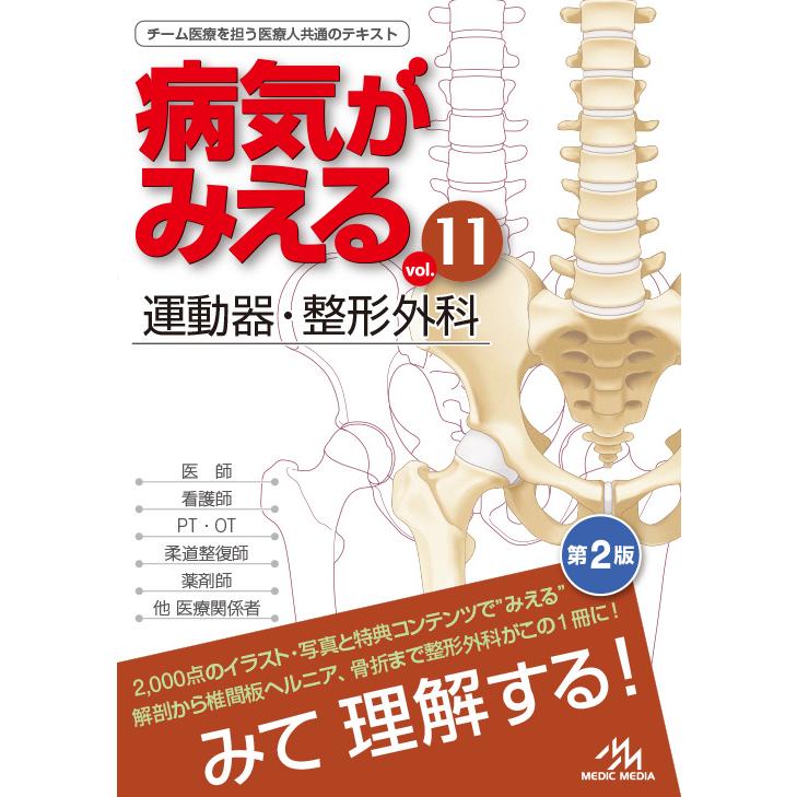 病気がみえる vol.11 運動器・整形外科 第2版 メディック 病気がみえる vol.11 運動器・整形外科 第2版 メディック