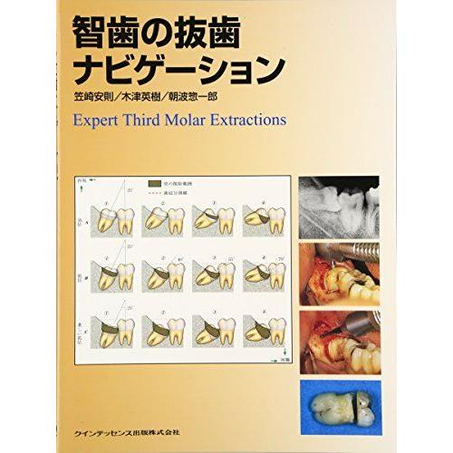 智歯の抜歯ナビゲ-ション 笠崎 安則 : ブックスドリーム 学参ストア1号