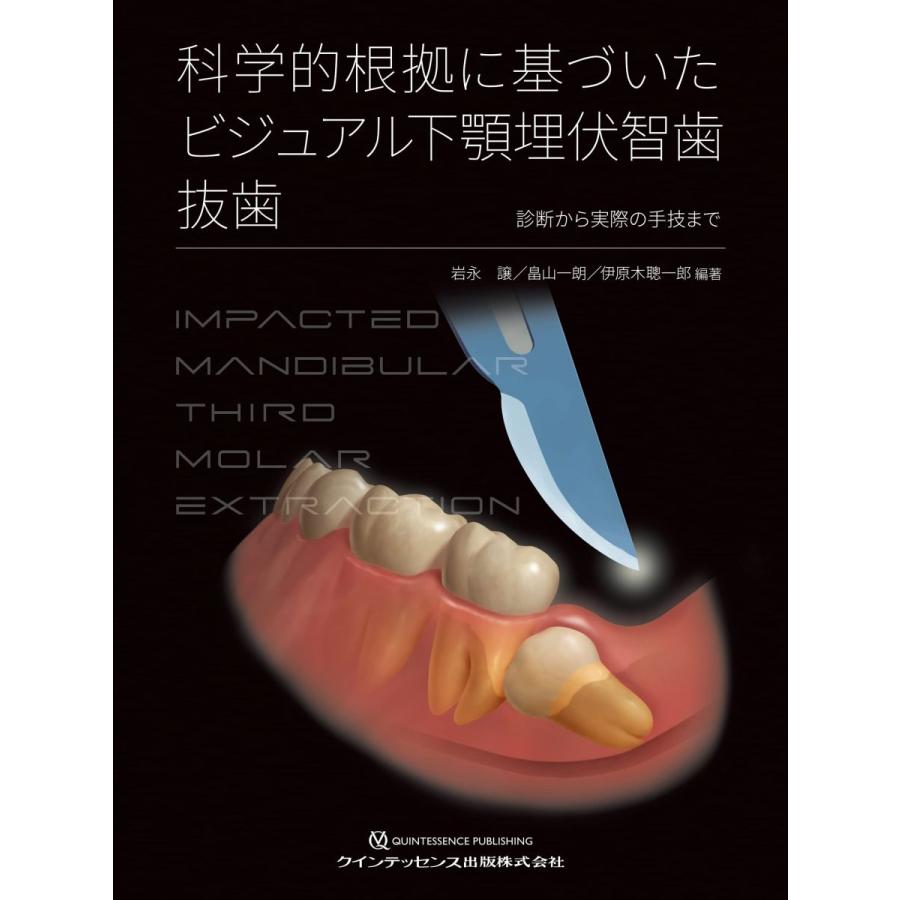 科学的根拠に基づいた ビジュアル下顎埋伏智歯抜歯 科学的根拠に基づいた ビジュアル下顎埋伏智歯抜歯 岩永 譲 畠山 一朗