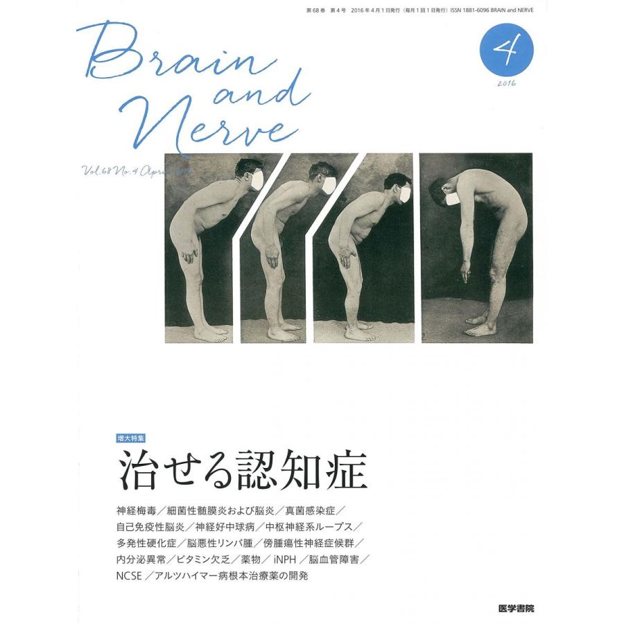 BRAIN AND NERVE 神経研究の進歩 2016年 4月号 増大特集 治せる認知症 BRAIN AND NERVE 神経研究の進歩 2016年 4月号 増大特集 治せる認知症
