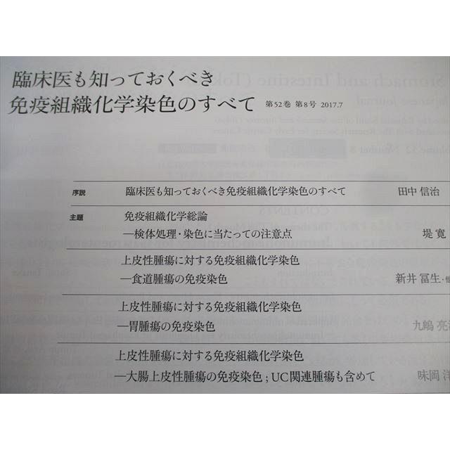 医学書院 胃と腸 2017年7月号 008m3B : ブックスドリーム 学参ストア2