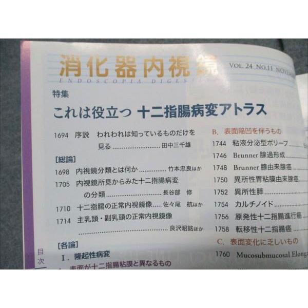 東京医学社 消化器内視鏡 2012年11月号 Vol.24 No.11 006m3D 東京医学社 消化器内視鏡 2012年11月号 Vol.24 No.11 006m3D