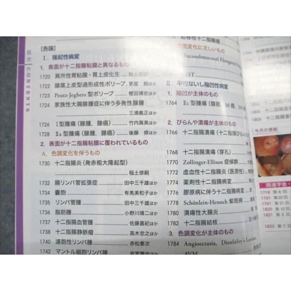 東京医学社 消化器内視鏡 2012年11月号 Vol.24 No.11 006m3D 東京医学社 消化器内視鏡 2012年11月号 Vol.24 No.11 006m3D