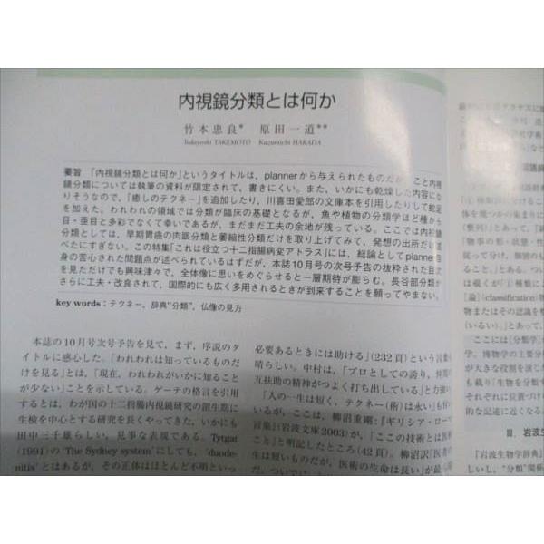東京医学社 消化器内視鏡 2012年11月号 Vol.24 No.11 006m3D