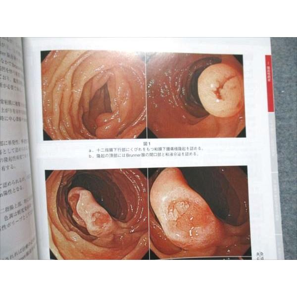 東京医学社 消化器内視鏡 2012年11月号 Vol.24 No.11 006m3D 東京医学社 消化器内視鏡 2012年11月号 Vol.24 No.11 006m3D