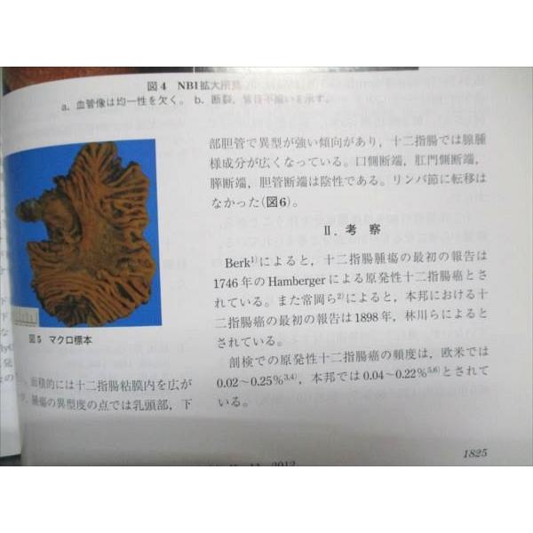 東京医学社 消化器内視鏡 2012年11月号 Vol.24 No.11 006m3D