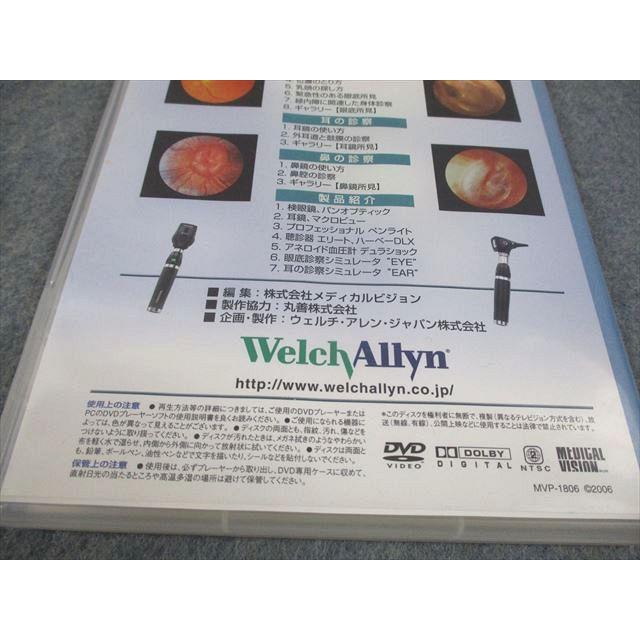 ウェルチ・アレン・ジャパン 臨床における診断器具【検眼鏡・耳鏡・鼻