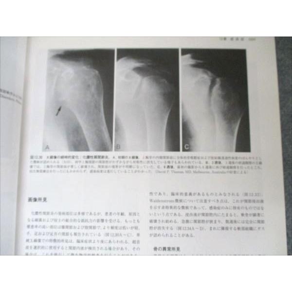 大系　骨・関節の画像診断 I エンタプライズ 大系 骨・関節の画像診断IV 2001 T.R Yochim&L.J.Rowe