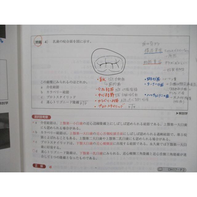 SP92-017 日本医歯薬研修協会 261/262 歯科衛生士国家試験 全国総合