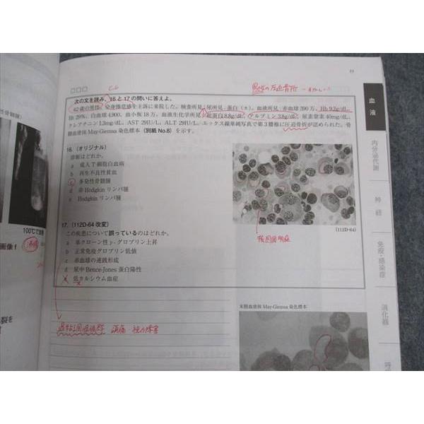 MEC 医師国家試験 臓器別/マイナー対策講座/他 血液/他 2022年合格目標