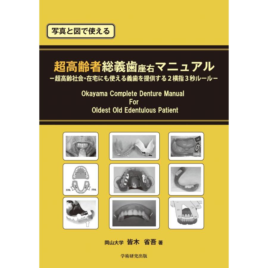 写真と図で使える　超高齢者総義歯座右マニュアル／皆木 省吾｜bookwayshop