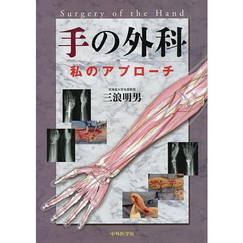 手の外科 私のアプローチ/三浪明男